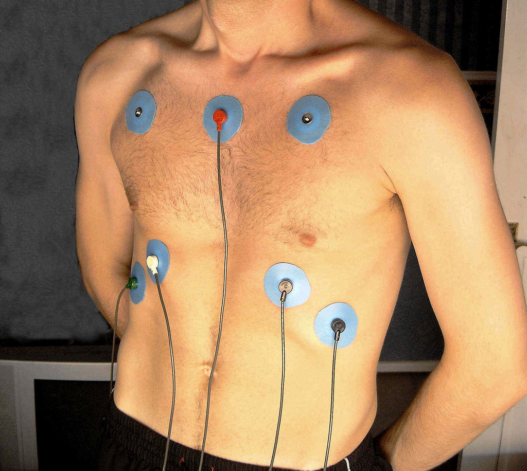 Electrocardiogram